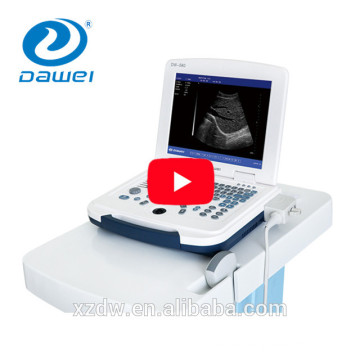 2017 nuevos precios actualizados de la máquina portátil de ultrasonido embarazada
